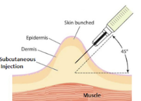 How To Safely Buy Melanotan 2 Tanning Injections Starter Kit In The UK